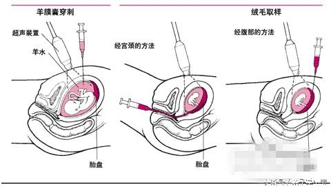 怀孕看男女的方法有哪些？陈女士告诉你真相